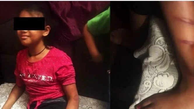ಕಣ್ಣೀರಿನ ಕಥೆ: ತಂದೆ ಮಗುವಿನ ಮೇಲೆ ಮನಬಂದಂತೆ ಹಲ್ಲೆ ನಡೆಸಿದ ಘಟನೆ A tearful story: An incident where a father assaulted his child indiscriminately