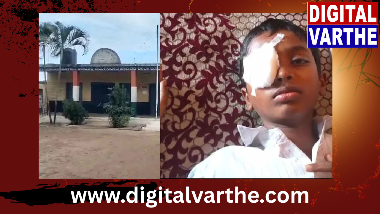 ಪೆನ್ನಿನ ವಿಷಯಕ್ಕೆ ಜಗಳ: 5ನೇ ತರಗತಿ ವಿದ್ಯಾರ್ಥಿಯ ಕಣ್ಣುಗುಡ್ಡೆ ಕಿತ್ತ 1ನೇ ತರಗತಿ ವಿದ್ಯಾರ್ಥಿ